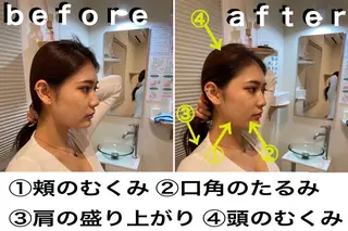 鍼灸整骨院Refine所属・鍼灸 Refineのその他イメージ