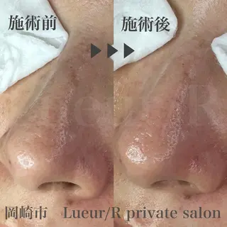 大久保 里奈のエステ・リラクイメージ