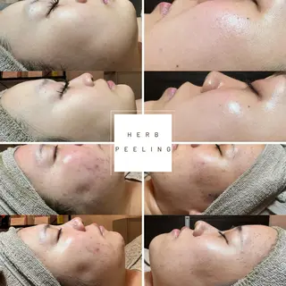 エステ✖️ネイル Feelのネイルデザイン