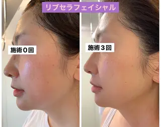 Private Salon Prunelle所属・プライベートサロン プリュネルのエステ・リラクイメージ