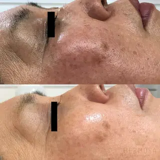 AprilEsthe所属・April EstheSalonのエステ・リラクイメージ