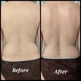 整体エステ　NEW ME所属・深層リンパオイル/小 顔とドライヘッドスパのエステ・リラクイメージ