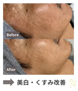 エイジングケア専門 Ponolaのエステ・リラクイメージ