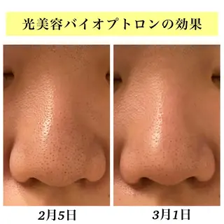 Bellesthe (ベルエステ)のエステ・リラクイメージ