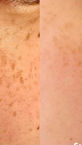 ポーラザビューティー松原店所属・ポーラ松原店 北口のエステ・リラクイメージ