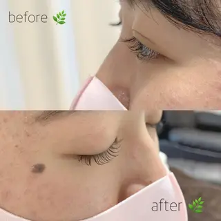 マツエク・マツパ nana♡ボブ 耳ツボジュエリー💞のその他イメージ