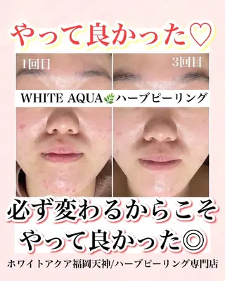 メンズ キッズ WHITEAQUA 福岡天神店のエステ・リラクイメージ