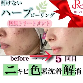 laluna saki...のその他イメージ