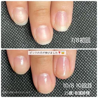 ネイル 奥園 良恵のネイルデザイン