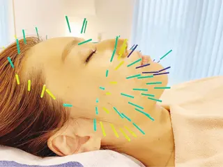 小顔美容鍼専門サロン 渋谷YZのエステ・リラクイメージ