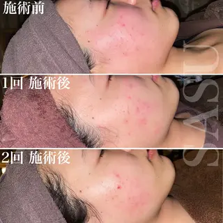 鍼灸×ハーブピーリングサロンSASU所属・石井 稚乃のその他イメージ