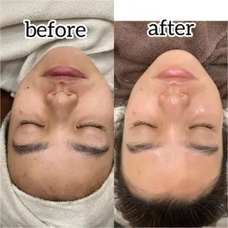 laluna saki...のその他イメージ