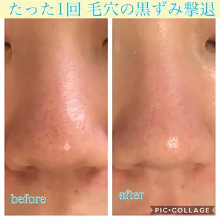 ショート カラー パーマ ヘアアレンジ キッズ ネイル マツエク・マツパ Ensor Clair所属・EnsorClair 代表 野口真央のエステ・リラクイメージ