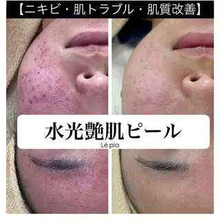 肌質管理専門店 Lé pia　AMIのエステ・リラクイメージ