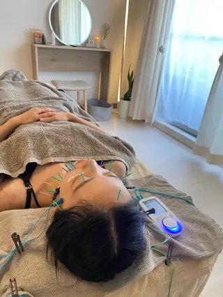 鍼灸•マッサージサロンCalfa所属・《美肌･小顔》美容鍼 ＆マッサージ＊MEIのエステ・リラクイメージ