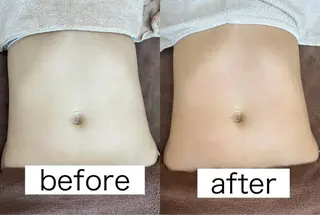 Beauty   Salon  Adiy所属・Adiy ikumiのエステ・リラクイメージ