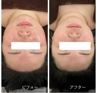 Relaxsalon undo所属・Relaxsalon undoのエステ・リラクイメージ