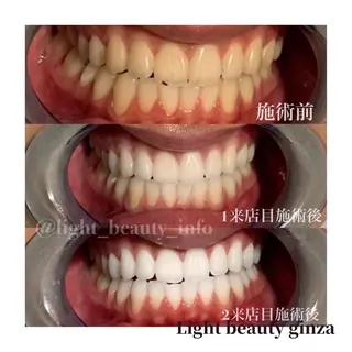 ライトビューティー 銀座本店のエステ・リラクイメージ