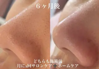 private salon Dea_maris シュガーリング&パーソナルボディケア所属・シミ改善・韓国肌管理 ボディメイク痩身のその他イメージ