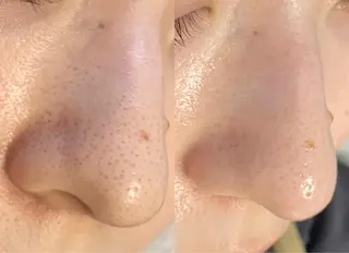 メンズ salonLADYSTYLE所属・稲嶺 美華のエステ・リラクイメージ