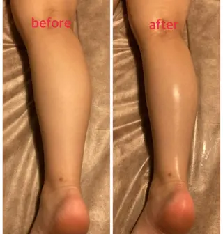 bellissimo 【ベリッシモ】所属・ちひろ　痩身/ハーブ bellissimoのエステ・リラクイメージ