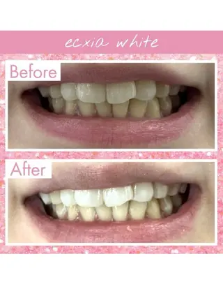 セルフホワイトニングサロン　エクシアホワイト西尾店所属・エクシアホワイト西尾 堀内恵のその他イメージ