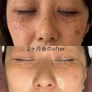 Rifuro毛穴ケア &よもぎ蒸しサロンの眉毛・アイブロウイメージ