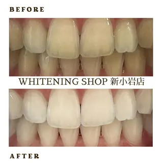 メンズ ホワイトニング ショップ新小岩店のその他イメージ