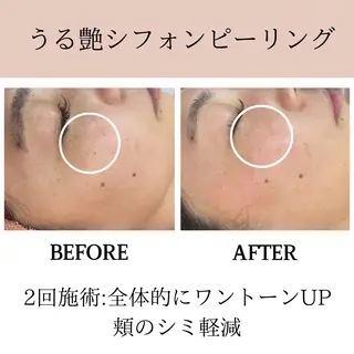 肌質改善専門サロン Bellmi/心斎橋のエステ・リラクイメージ