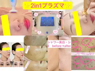 エレガンテ　ビューティーサロン所属・🎀エレガンテ🎀 美肌専門👸本間のその他イメージ