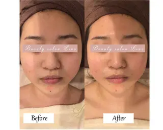 痩身×フェイシャル ブライダル|Linoのエステ・リラクイメージ