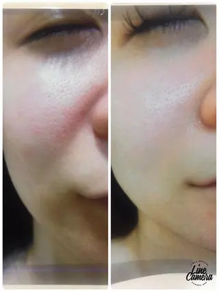 本格エステの ヘッドスパのその他イメージ