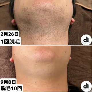 メンズ Beauty Salon MARU所属・新潟市メンズ【脱毛】 MARUのエステ・リラクイメージ