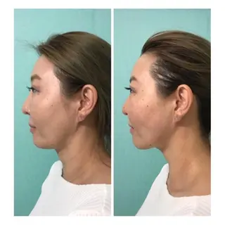 Salonde ELSA／河合のエステ・リラクイメージ