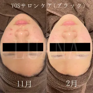 LUANA TAKAGIの眉毛・アイブロウイメージ