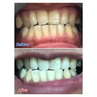 MBEAUTYSALON 千葉店・京成大久保所属・Melty 輝のその他イメージ