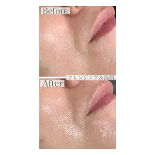 小顔とダイエット LibéCharmeのエステ・リラクイメージ