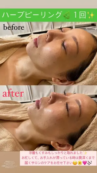 Salon de Lino 御器所のエステ・リラクイメージ