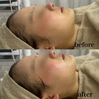 フェイシャルサロン CHIARA 荒田のエステ・リラクイメージ