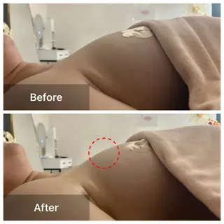 Sol.Diosa所属・Sol.Diosa 井上のエステ・リラクイメージ