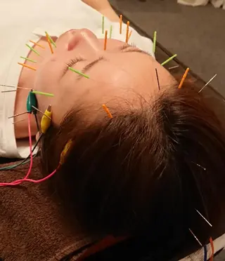 鍼灸サロンKEYAKI所属・美容鍼灸師 皆吉 秀樹のエステ・リラクイメージ