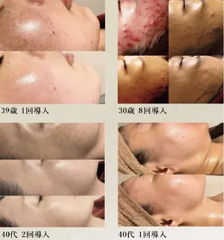 mimiluce ミミルーチェのマツエク・マツパデザイン