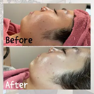 hair make echo所属・hair make echo 大橋亜弥のエステ・リラクイメージ