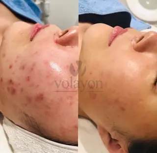 韓国風eyelush 眉毛サロン/Suuのマツエク・マツパデザイン