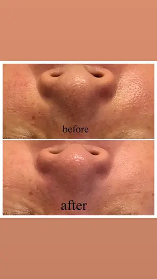 Monreve所属・美人スイッチdiet スーパージェクションのその他イメージ