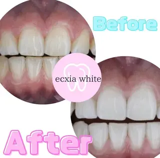 エクシアホワイトニング草津店所属・エクシア ホワイトニング草津店のその他イメージ