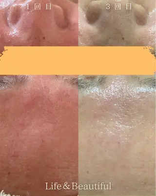 Life＆ Beautifulのエステ・リラクイメージ