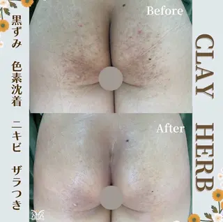 VIKI BEAUTY  クレイハーブピーリング・美肌脱毛専門店所属・VIKI BEAUTYのエステ・リラクイメージ