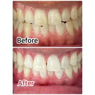 メンズ プラチナムビューティー柏所属・【歯科提携】柏ホワイ トニングスタイルのその他イメージ