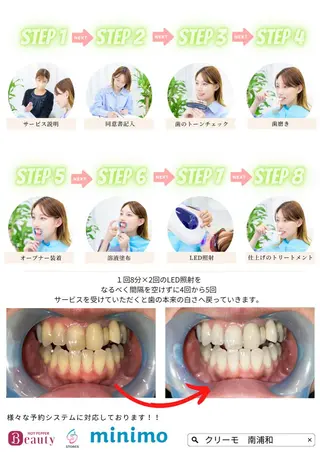歯のホワイトニング HARU南浦和のその他イメージ
